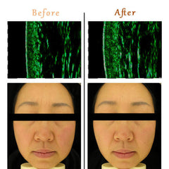 (new) Made in KOREA led face mask light therapy led mask red light IR photon skin rejuvenation
